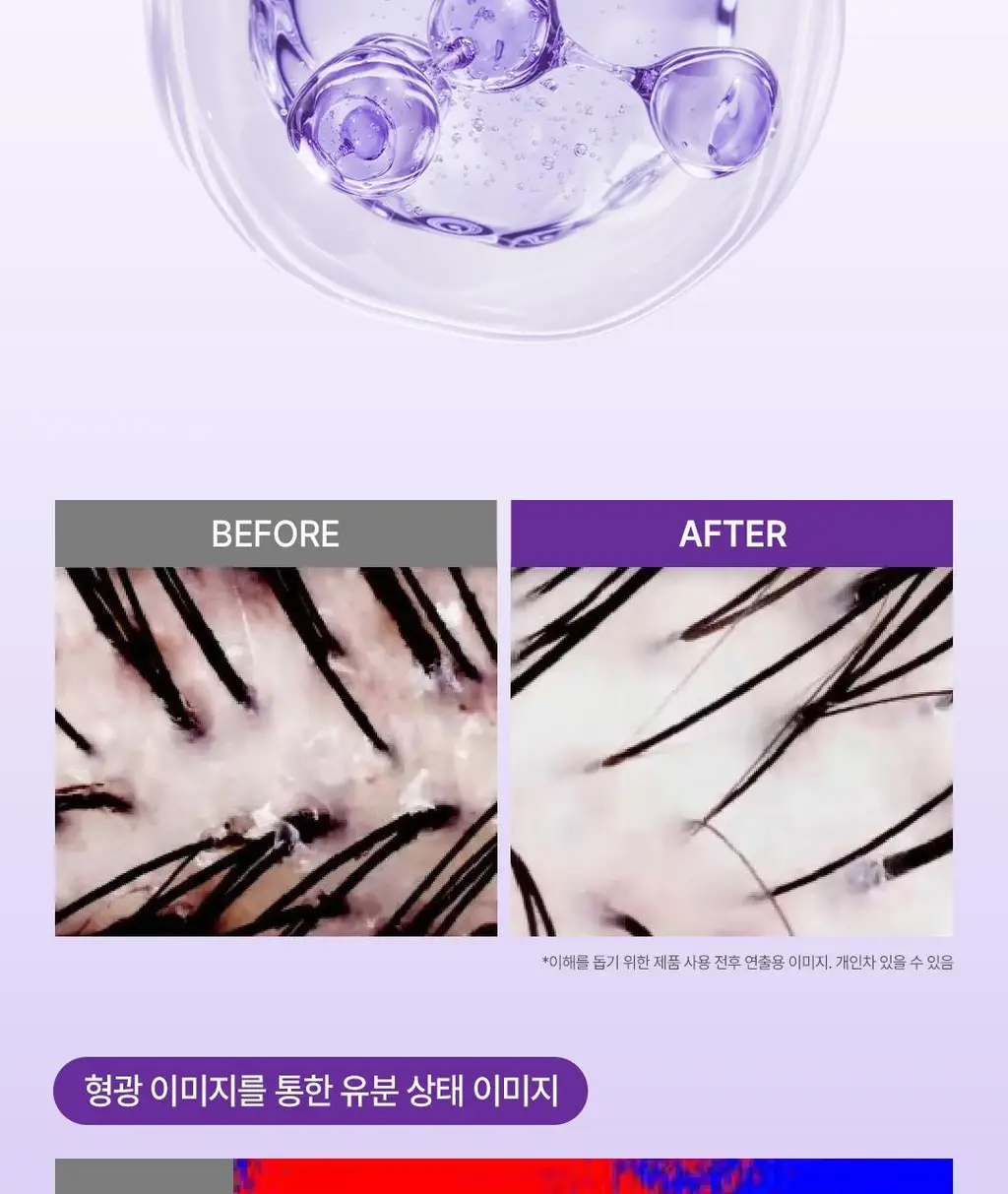 [+미니증정/수분볼륨UP]로레알파리 히알루론산 두피앰플샴푸 440ml 단품/기획(약산성) 상세페이지 11